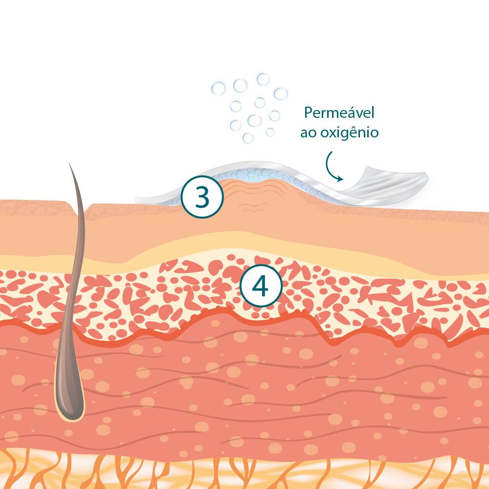 Silimed Tratamento de Cicatrizes Mecanismo de ação 2a etapa